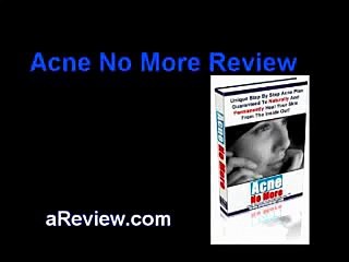 Acne No More- A Holistic Approach to Acne | Natural Remedy For Ance