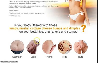 Cellulite Factor Solution By Dr. Charles Livingston Review - Is It Worth It?