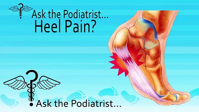 How Do I Know If I Have Plantar Fasciitis? Podiatrist Toronto, ON - Sheldon Nadal, DPM