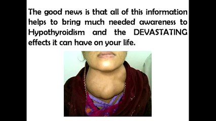 The Hypothyroidism Revolution Diet Plan | Best Diet For Hypothyroidism