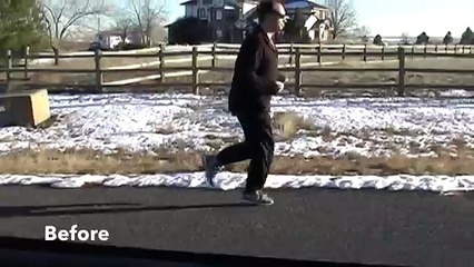Runner with Plantar Fasciitis Pain Free Fast with Running Form Correction