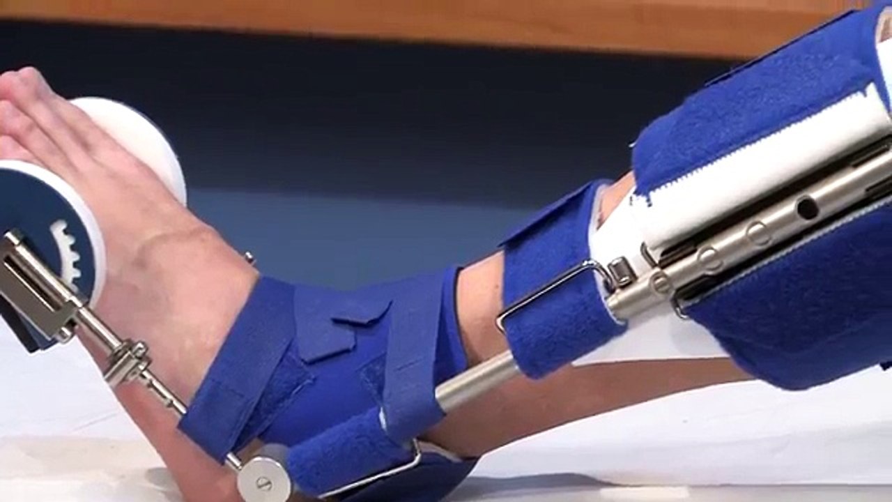 Dr. Stephen V  Perns:  Plantar Fasciitis & Achilles Tendonitis- A Dynasplint Review