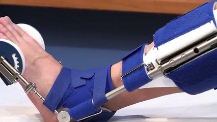 Dr. Stephen V  Perns:  Plantar Fasciitis & Achilles Tendonitis- A Dynasplint Review