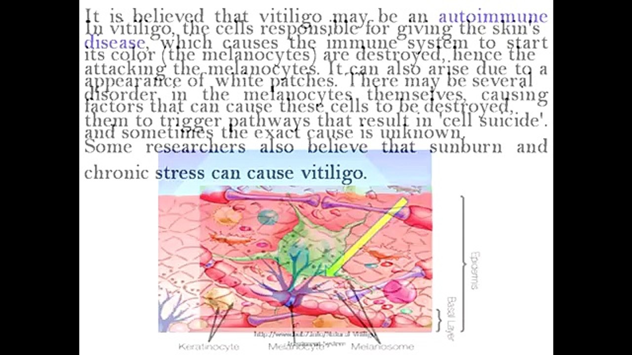 Natural Vitiligo Treatment System PDF | A Guide On Vitiligo Natural Treatments