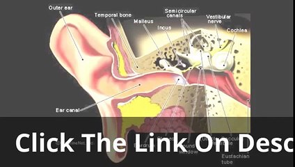 Tinnitus Miracle Doctors Review | Is Tinnitus Miracle As Good As It Sounds?