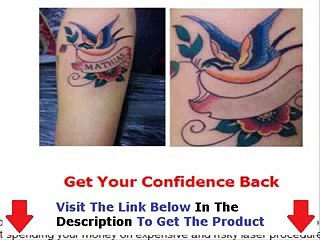 Get Rid Tattoo Get Discount Bonus + Discount