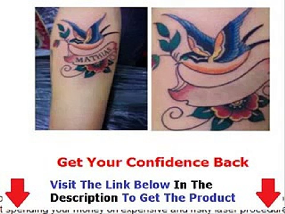 Get Rid Tattoo Get Discount Bonus + Discount