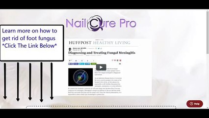 Nail Cure Pro|Nail Cure Pro Review- Is it worth it?