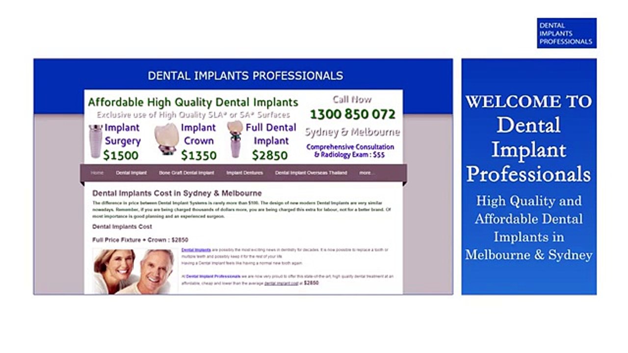 High Quality Dental Implants in Sydney