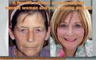 Facelift Without Surgery: Principles Of Effective Non-Surgical Facelifts By Applying Face Gymnastics
