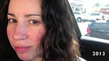 Rosacea: Skin Care Routine