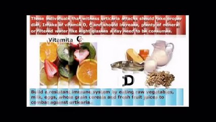 Full Urticaria Cure By Dr Gary M d Reviews-Is It Worth The Cost?