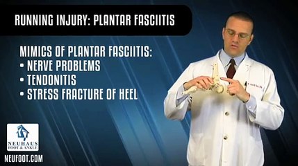 Is Plantar Fasciitis a Common Running Injury?