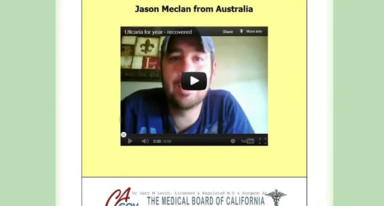 urticaria treatment How To Get Rid of Hives? | Treat it with Dr. Gary Levin's natural treatment