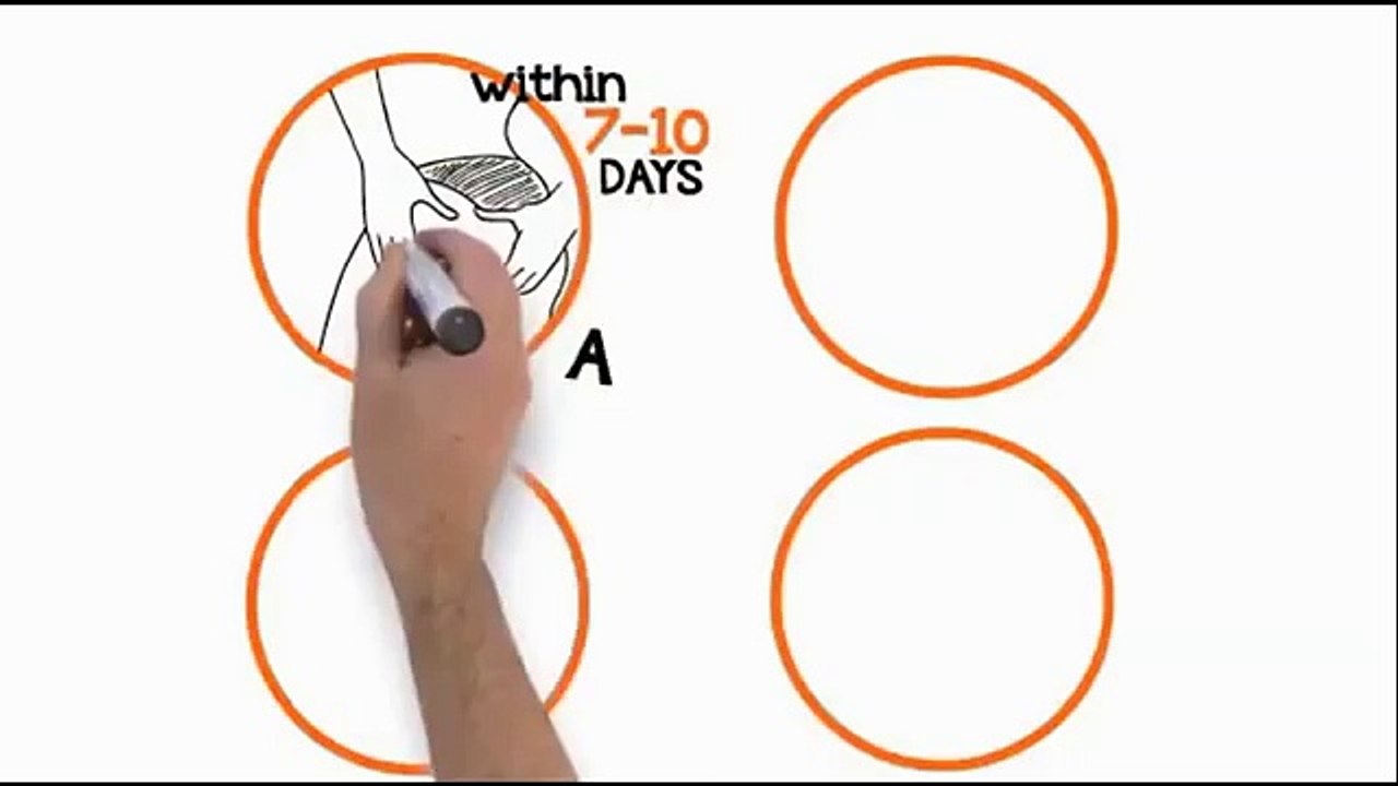 ANTI CELLULITE DIET |TRUTH ABOUT CELLULITE | CELLULITIS