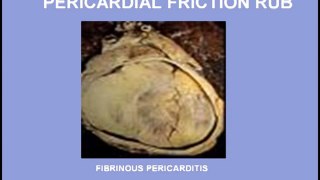 Heart Sounds - Pericardial Rub and Innocent Systolic Murmur (480p)
