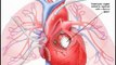 Heart Sounds Made Easy - Congenital Heart Defects (480p)