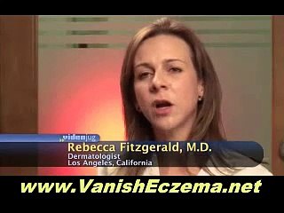 14 Days Eczema Cure Review - Can You Really Cure Your Eczema in 14 Days?