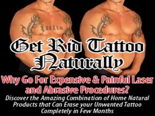 *Get Rid Tattoo Scam...