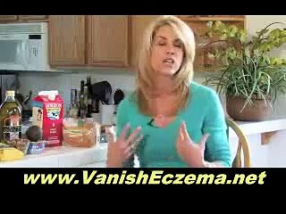 Can You Beat Eczema in 10 Days?