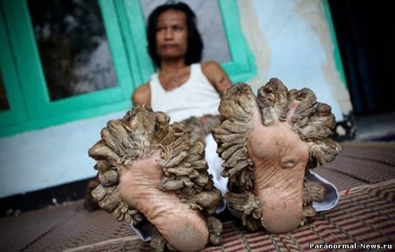 САМЫЕ ВЕЗУЧИЕ И НЕВЕЗУЧИЕ ЛЮДИ В МИРЕ ШОК СМОТРЕТЬ ВСЕМ