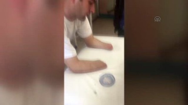 Akdeniz Üniversitesi'ndeki Üçüncü Çift Kol Nakli