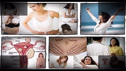Fibroids Miracle Reviews-Does It Work?