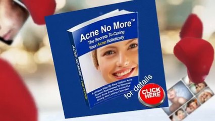 Acne No More Reviews-Is It Worth It?