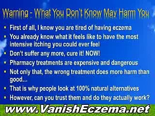 How To Cure Your Eczema | Beat Eczema