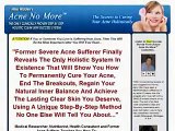 Acne No More - Book Review | Acne Natural Treatment | Natural Remedy For Ance