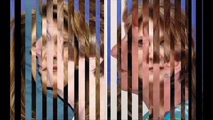 Facelift Without Surgery Reviews-Does It Really Work?