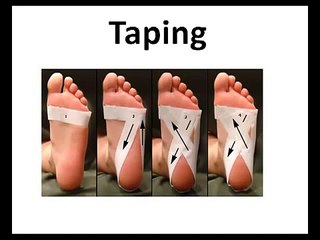 How To Get Plantar Fasciitis Pain Relief   YouTube