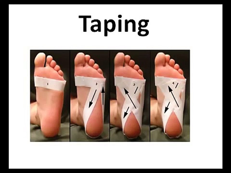 How To Get Plantar Fasciitis Pain Relief   YouTube