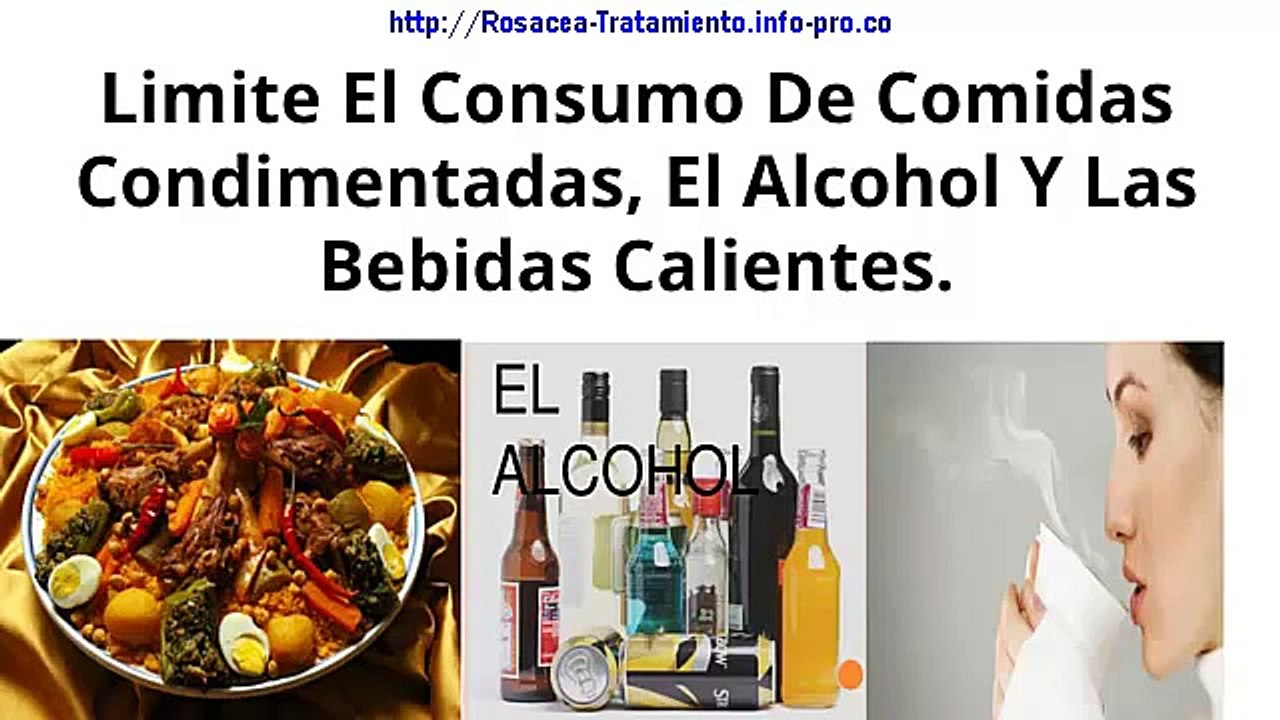 ❄❄Que Es La Rosacea, Que Tratamiento Usar Para La Rosacea, Dermatitis Rosacea, Sintomas Rosacea*