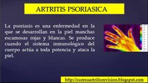 Cure Su Artritis | Artritis Psoriasica