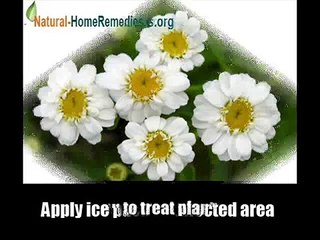 7 Natural Cures For Plantar Fasciitis