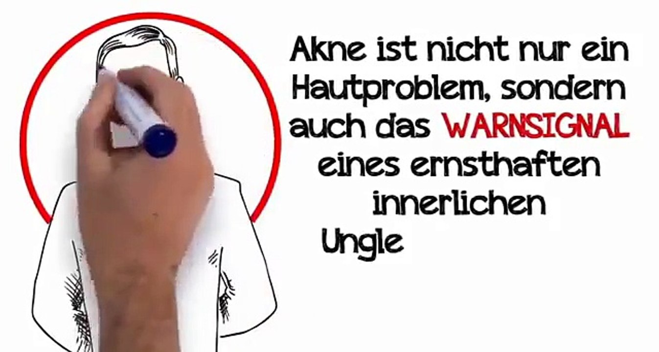 Nie mehr Akne   KOSTENLOSE Videopräsentation