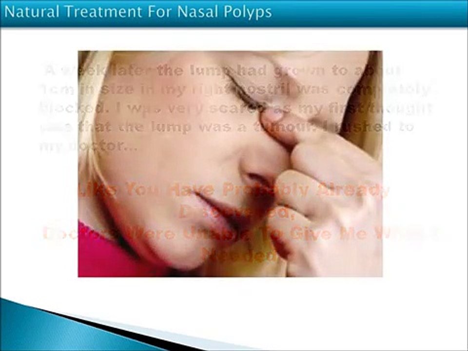 Nasal Polyps Natural Treatment |  Nasal Polyps Treatment Miracle