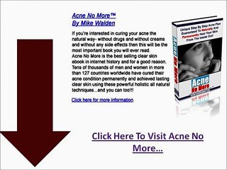 Acne No More - The Things You Should Never Do To Your skin When You Have Acne