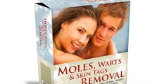 Moles, Warts, and Skin Tags Removal Review | Full Review of  Moles, Warts, and Skin Tags Removal