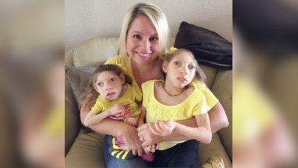 What this mom wants you to know about her daughters with microcephaly