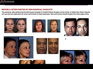 Facelift Without Surgery Review - Scam or Legit?
