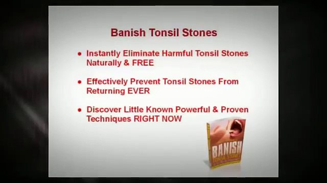 Banish Tonsil Stones | Banish Tonsil Stones PDF Download