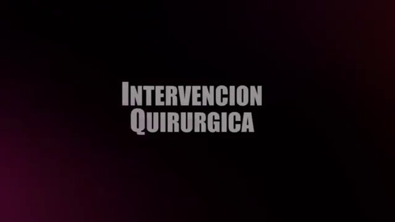 BREAST AUGMENTATION::AUMENTO DE BUSTO::BREAST IMPLANTS::CLINICA DEL REY