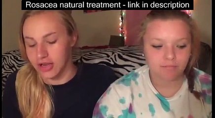 Cute Everyday Makeup Transformation | ItsMichaelBailey - laser rosacea treatment