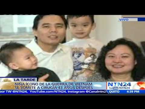 ¡Cerrando cicatrices! ‘Niña del napalm’ recibe tratamiento con láser en Miami para reducir dolor