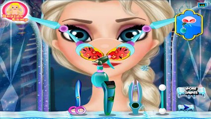 Elsa Nose Doctor - Frozen Games To Play - totalkidsonline