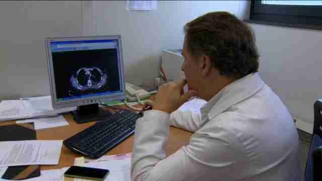 Un novedoso tratamiento para el cáncer de pulmón aumenta la esperanza de vida de los pacientes.