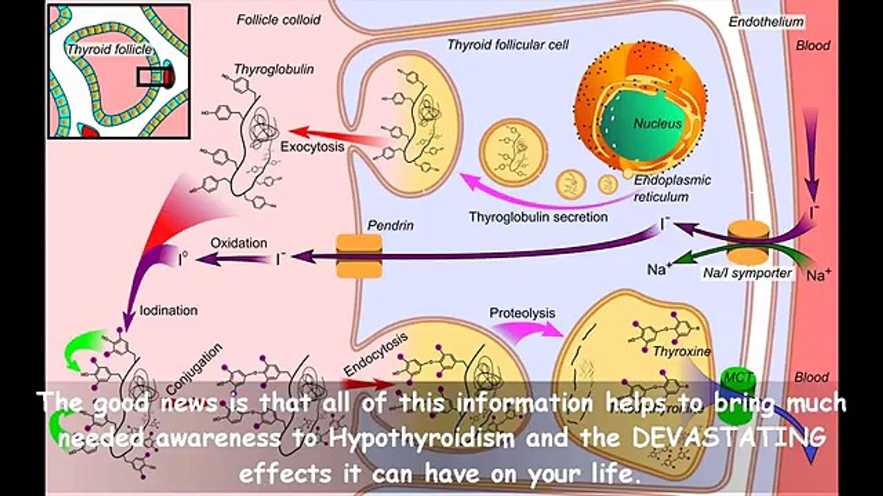 Does The Hypothyroidism Revolution Work | Warning | Does The Hypothyroidism Revolution Really Work