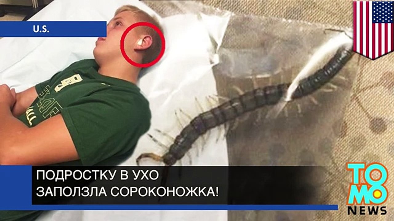 Подростку в ухо заползла сороконожка